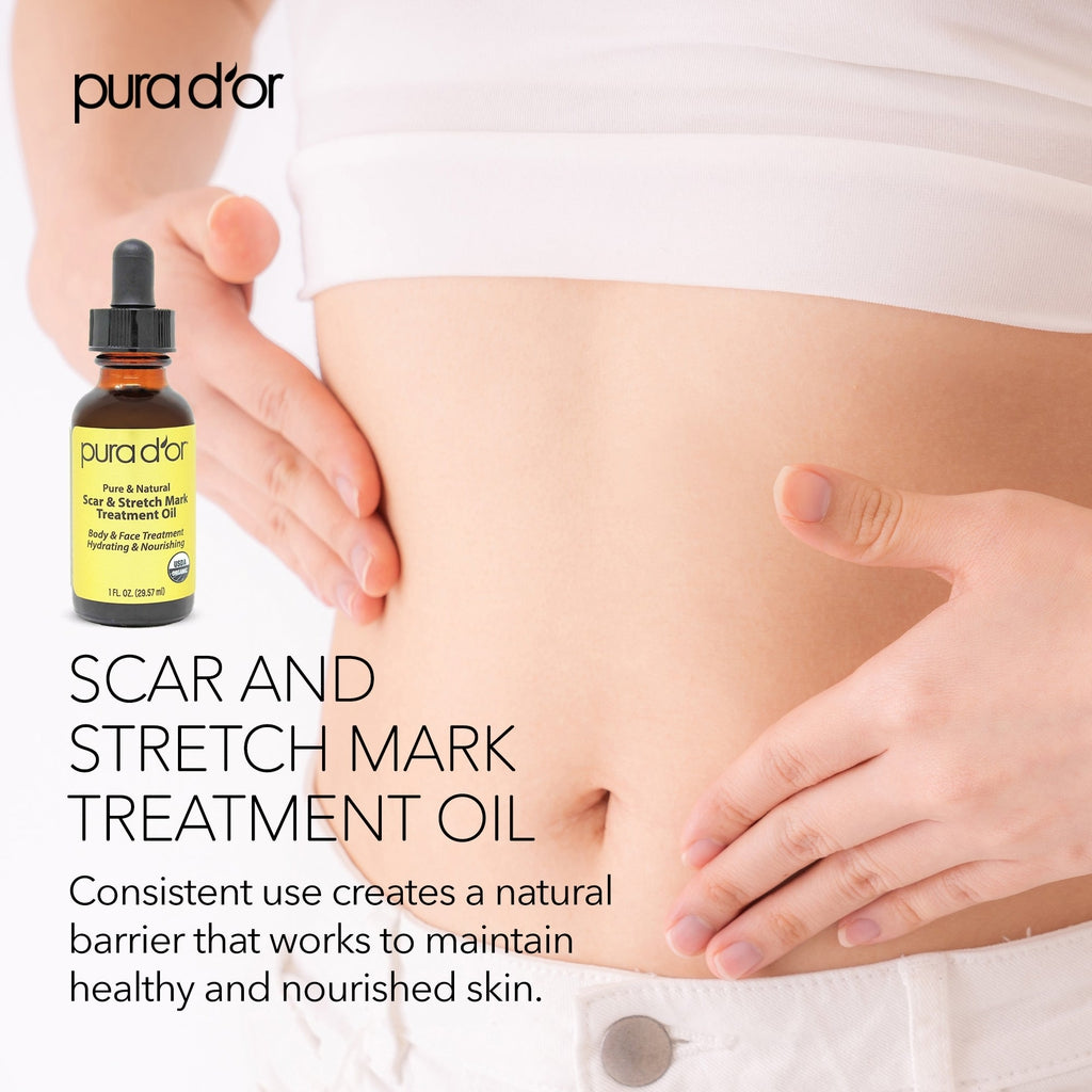 Scar and Stretch Mark Treatment Oil 1 oz
