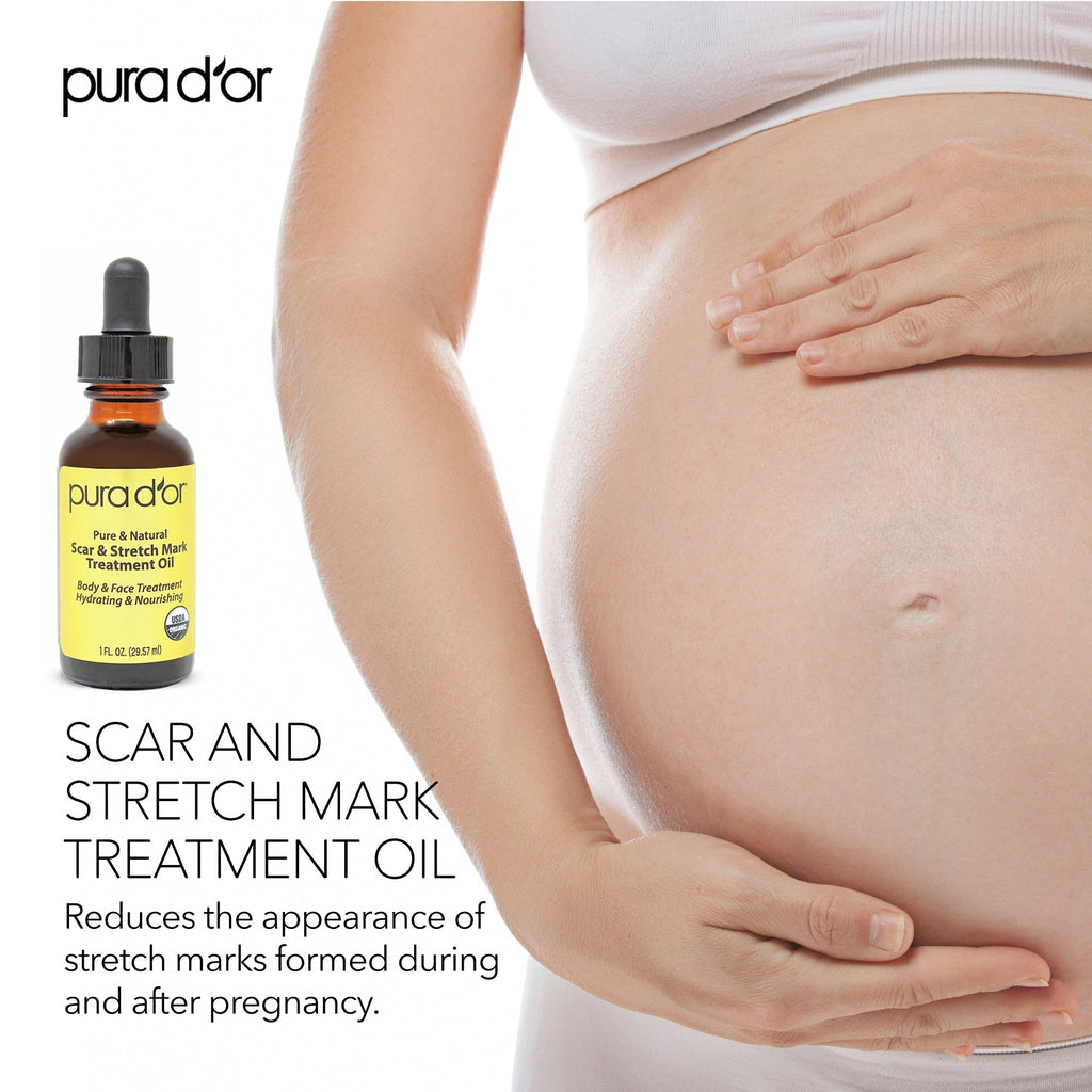 Scar and Stretch Mark Treatment Oil 1 oz