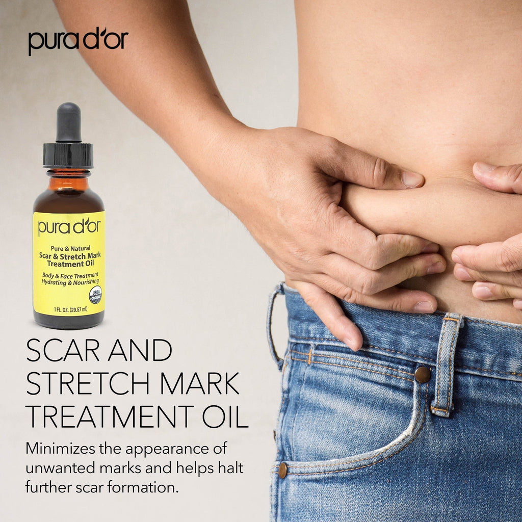 Scar and Stretch Mark Treatment Oil 1 oz