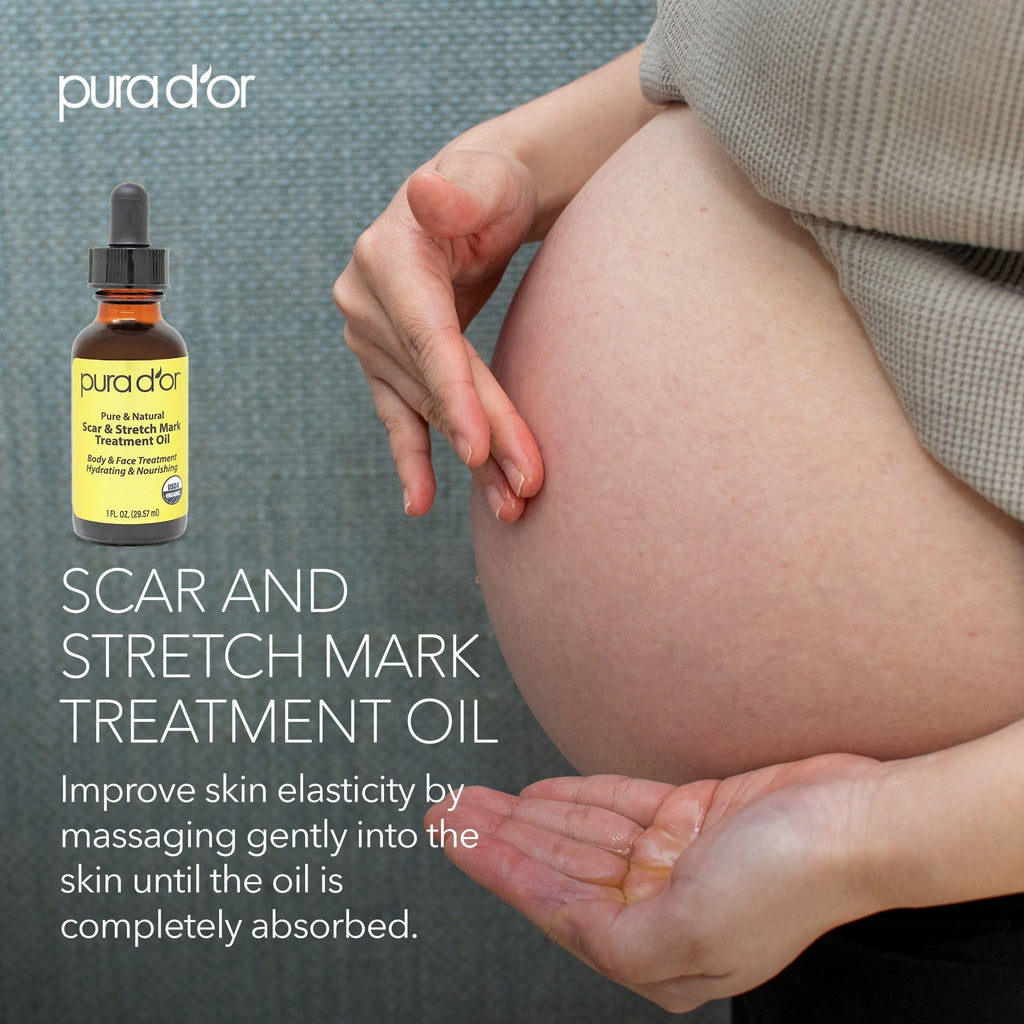 Scar and Stretch Mark Treatment Oil 1 oz