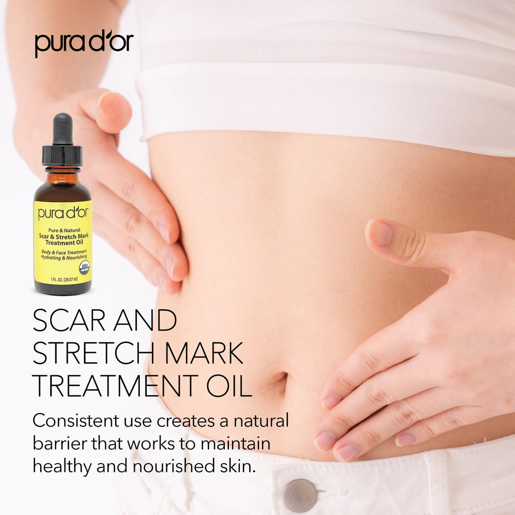 Scar and Stretch Mark Treatment Oil 1oz